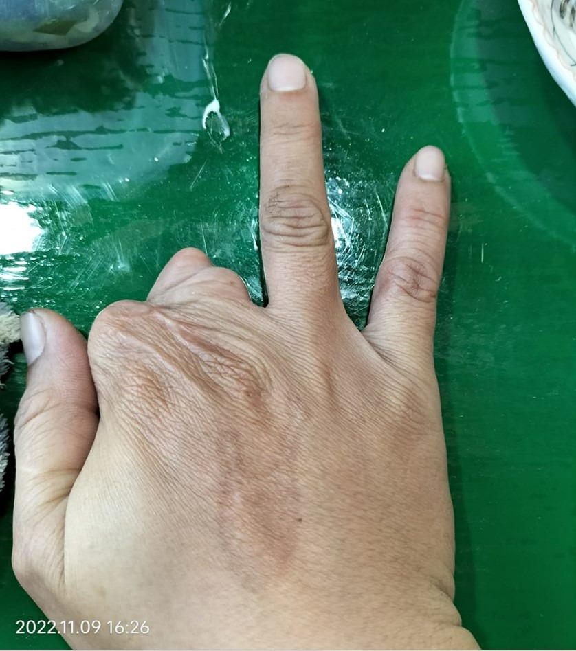 如何失掉有效的健康码