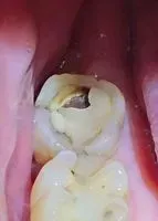 臥冰不清