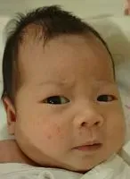 髮漸白眼漸盲