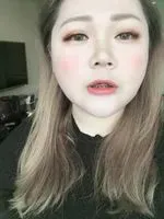 頸動脈